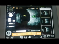 وظيفة حساب IOL آلة الماسح الضوئي بالموجات فوق الصوتية 10 ميجا هرتز عالية الدقة المحورية