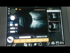 ب - جهاز المسح بالموجات فوق الصوتية - فحص أمراض الجسم الزجاجي الكهرومغناطيسي