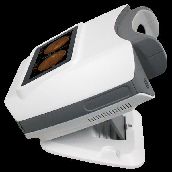Kestrel 300 Portable Fundus Camera with 50° Field of View 3.0mm Minimum Pupil Size and 15mm Working Distance for Ophthalmic Medical Technology